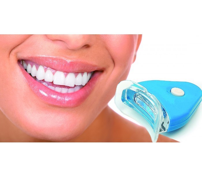 Kit de blanchiment des dents – Résultats dents blanches en 20 minutes
